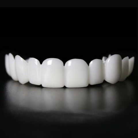 Removable Resin Full-Arch Snap-On Veneers